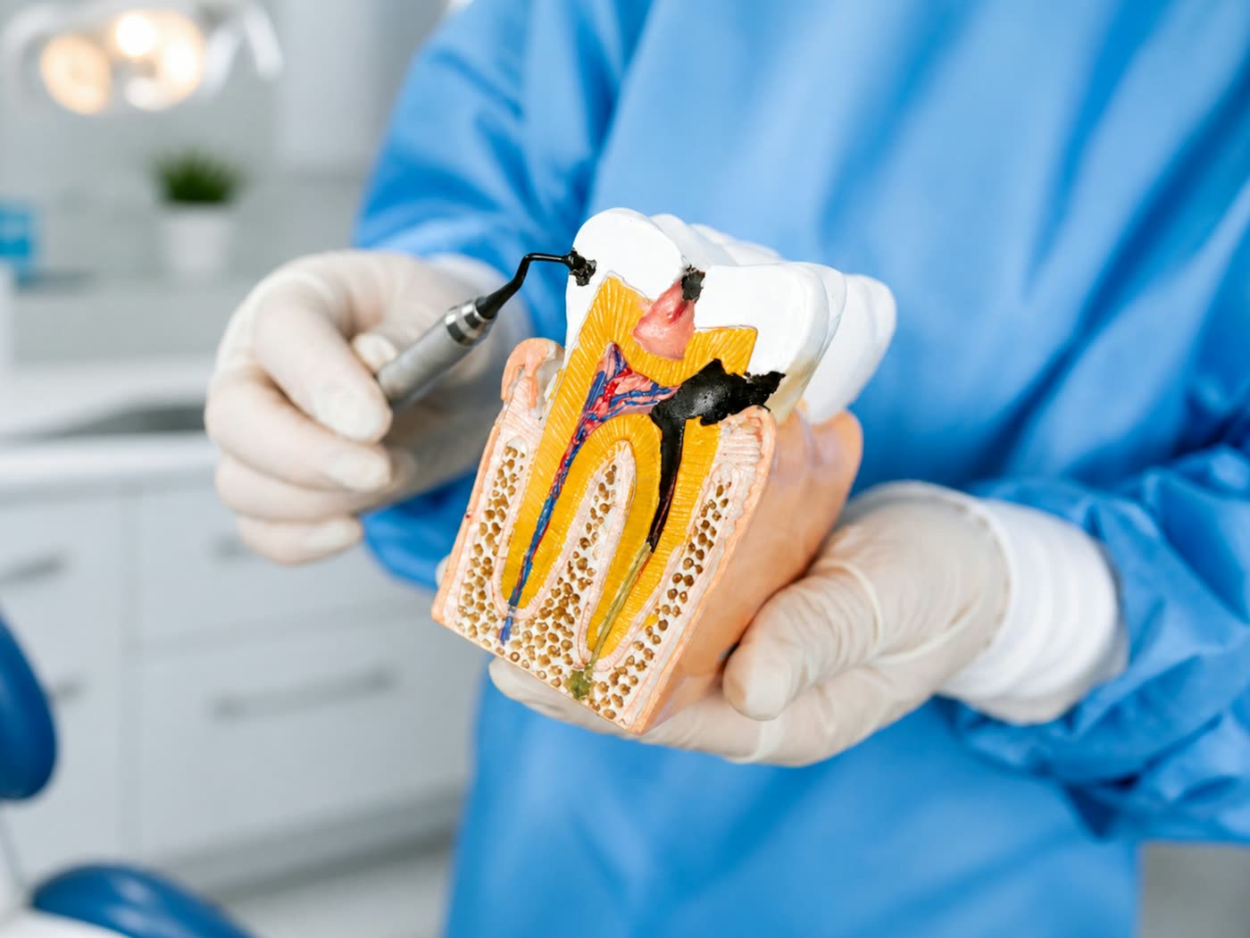 Endodontie – Zahnarztpraxis Tülay Onan